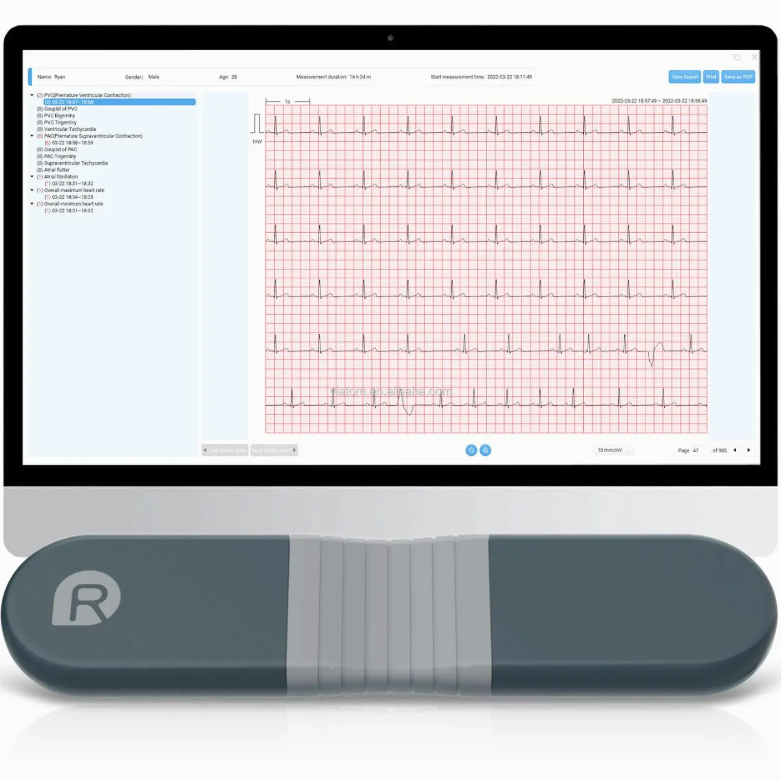 Wireless Bluetooth Dynamic Rec - مراجعة Ecg Patch Monitor وسعره